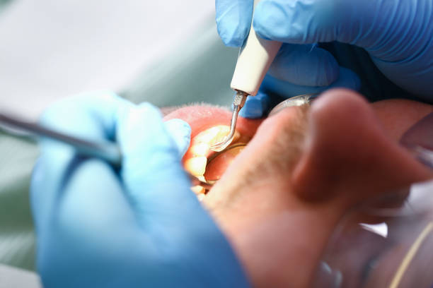 Best Urgent Dental Care for Toothaches in Palm River Clair Mel, FL